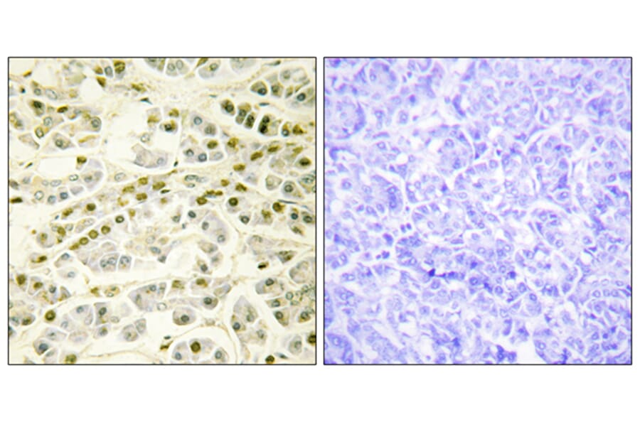 Immunohistochemistry - Anti-RAD51L1 Antibody (C13106) - Antibodies.com