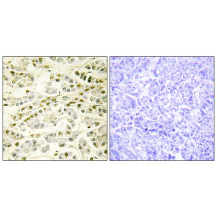 Immunohistochemistry - Anti-RAD51L1 Antibody (C13106) - Antibodies.com