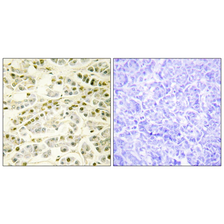Immunohistochemistry - Anti-RAD51L1 Antibody (C13106) - Antibodies.com