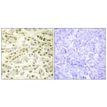 Immunohistochemistry - Anti-RAD51L1 Antibody (C13106) - Antibodies.com
