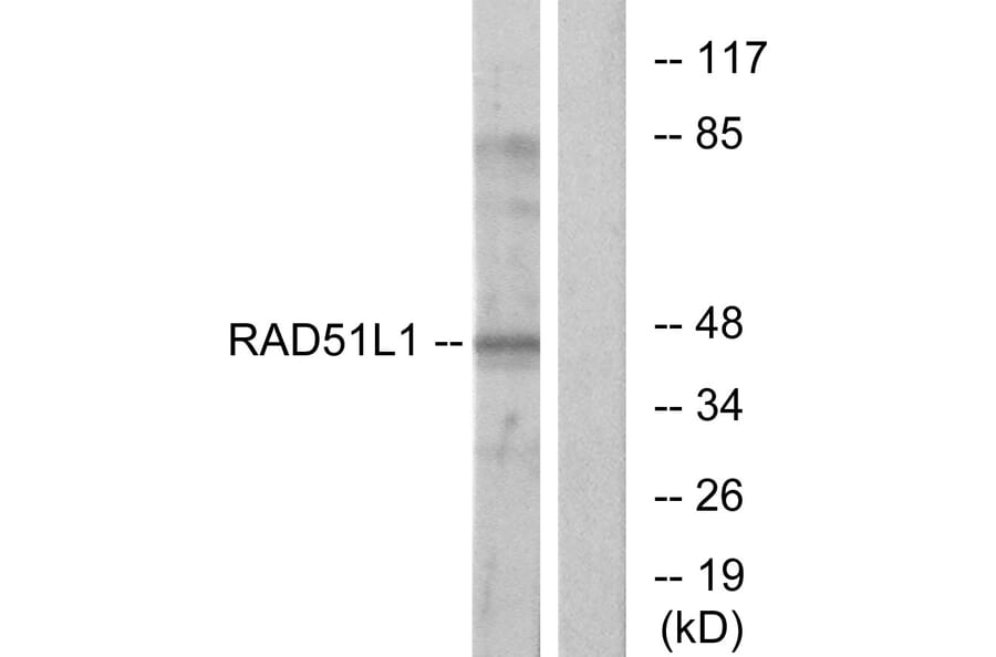 Western Blot - Anti-RAD51L1 Antibody (C13106) - Antibodies.com