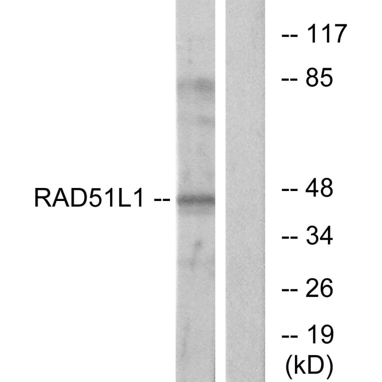 Western Blot - Anti-RAD51L1 Antibody (C13106) - Antibodies.com
