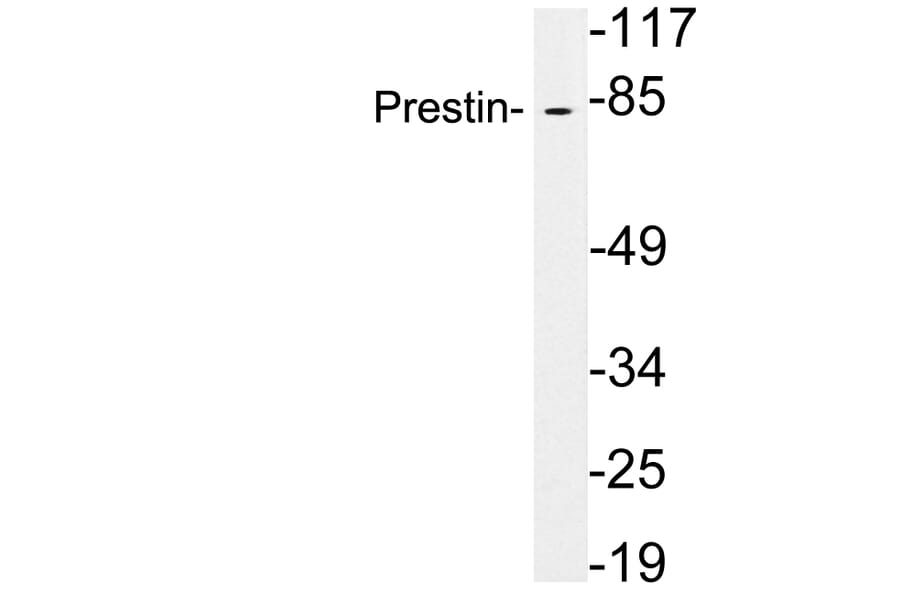 Western Blot - Anti-Prestin Antibody (R12-2320) - Antibodies.com