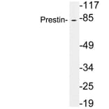 Western Blot - Anti-Prestin Antibody (R12-2320) - Antibodies.com