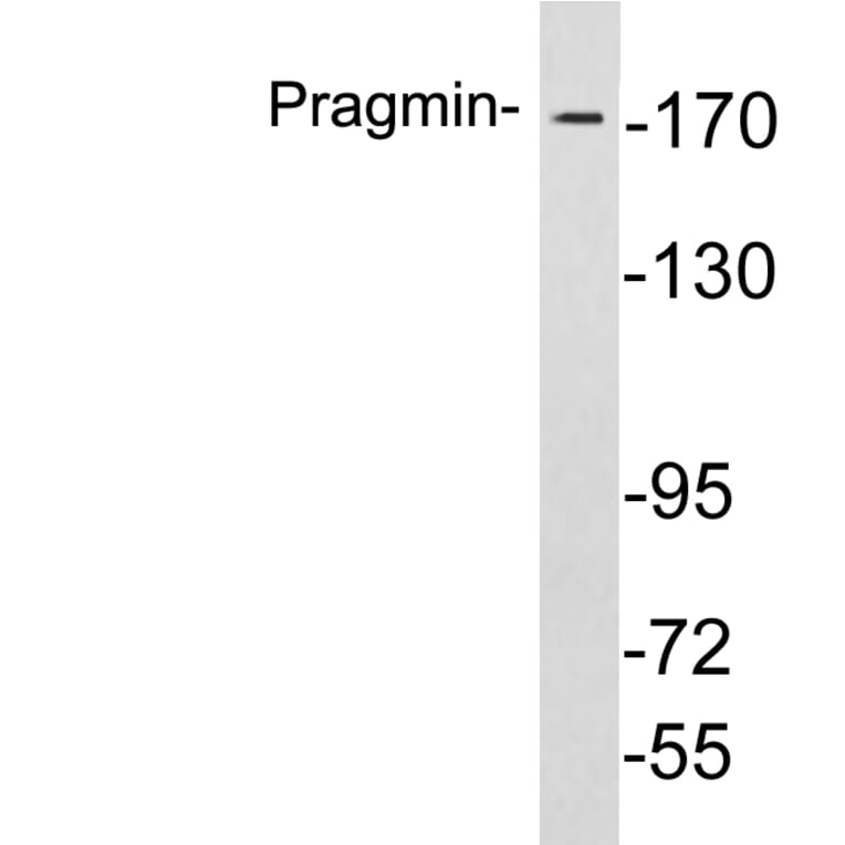 Western Blot - Anti-Pragmin Antibody (R12-2318) - Antibodies.com