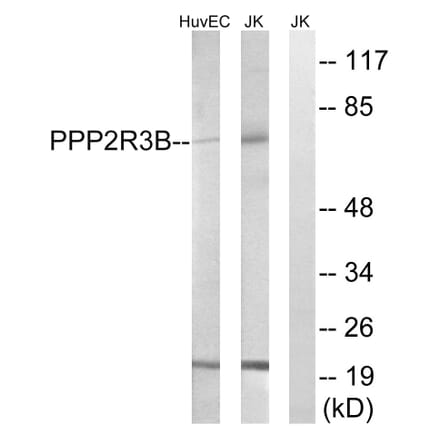 Western Blot - Anti-PPP2R5D Antibody (C18645) - Antibodies.com