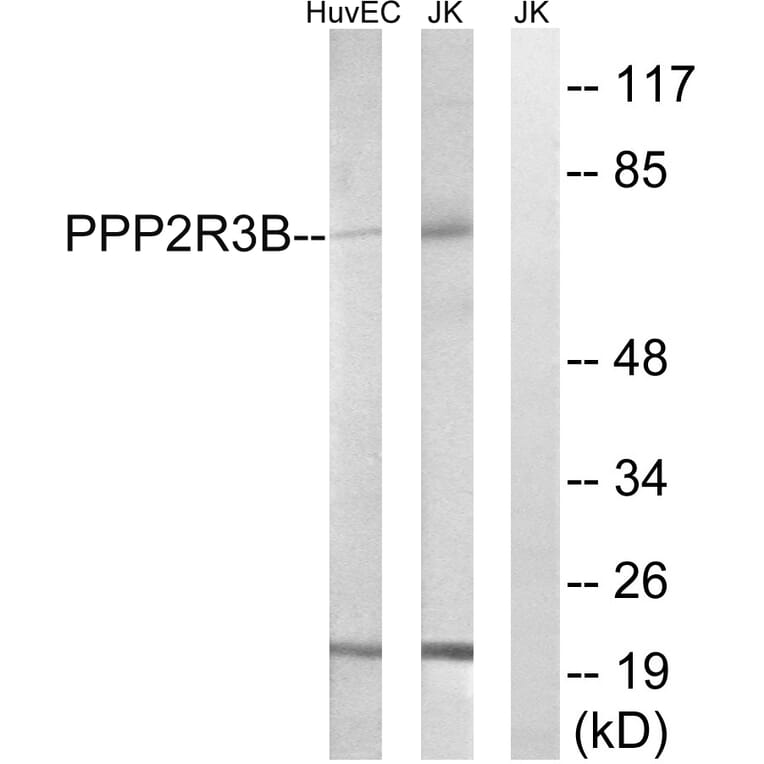 Western Blot - Anti-PPP2R5D Antibody (C18645) - Antibodies.com