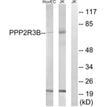 Western Blot - Anti-PPP2R5D Antibody (C18645) - Antibodies.com