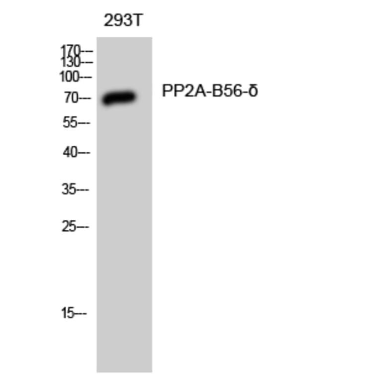 Western Blot - Anti-PPP2R5D Antibody (C18645) - Antibodies.com