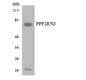 Western Blot - Anti-PPP2R5D Antibody (R12-3357) - Antibodies.com