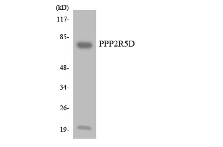 Western Blot - Anti-PPP2R5D Antibody (R12-3357) - Antibodies.com