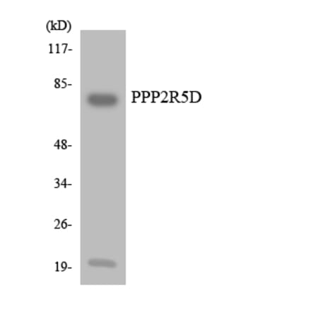 Western Blot - Anti-PPP2R5D Antibody (R12-3357) - Antibodies.com