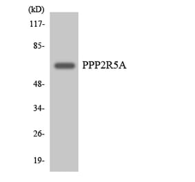 Western Blot - Anti-PPP2R5A Antibody (R12-3356) - Antibodies.com