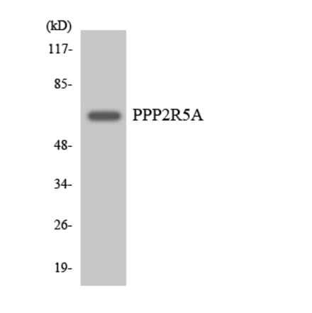 Western Blot - Anti-PPP2R5A Antibody (R12-3356) - Antibodies.com