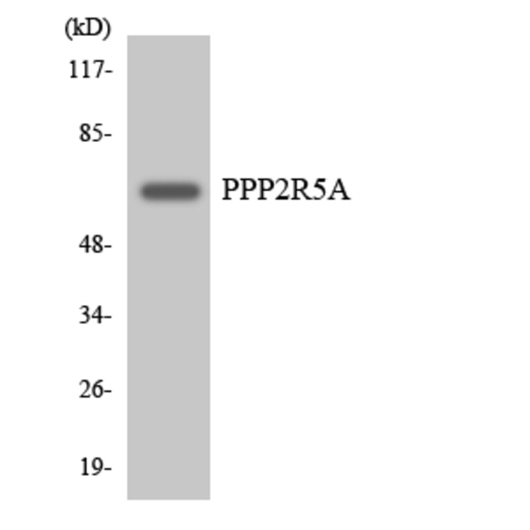 Western Blot - Anti-PPP2R5A Antibody (R12-3356) - Antibodies.com