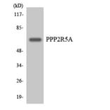 Western Blot - Anti-PPP2R5A Antibody (R12-3356) - Antibodies.com