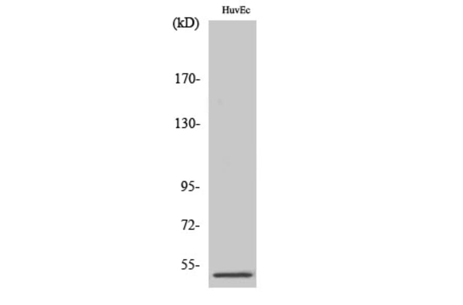 Western Blot - Anti-PPP2R3C Antibody (C18655) - Antibodies.com