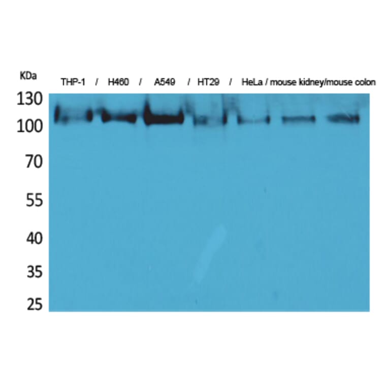 Western Blot - Anti-PLA2G4A Antibody (C30097) - Antibodies.com