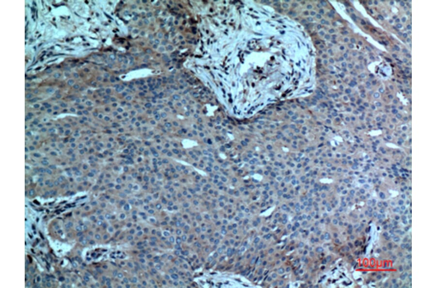 Immunohistochemistry - Anti-PLA2G4A Antibody (C30097) - Antibodies.com