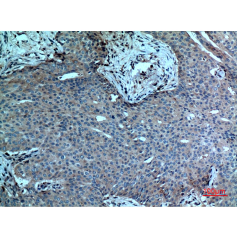 Immunohistochemistry - Anti-PLA2G4A Antibody (C30097) - Antibodies.com