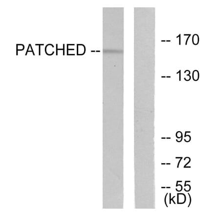 Western Blot - Anti-Patched Antibody (C0296) - Antibodies.com