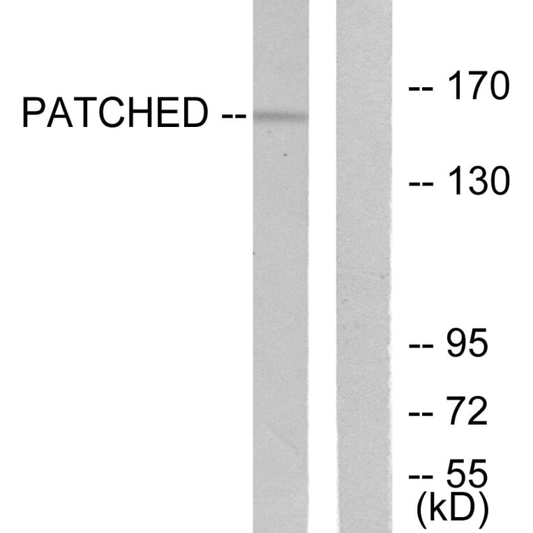 Western Blot - Anti-Patched Antibody (C0296) - Antibodies.com