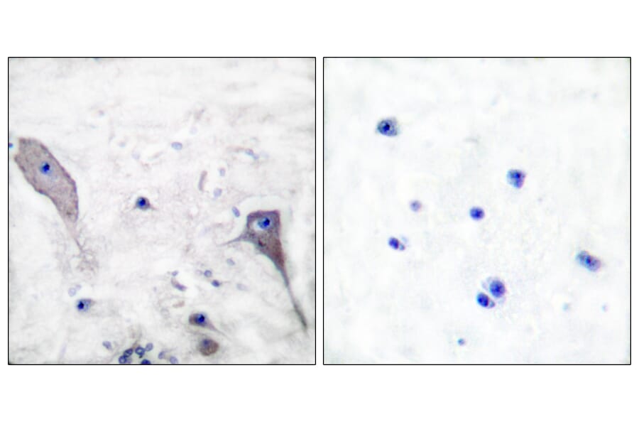 Immunohistochemistry - Anti-Patched Antibody (C0296) - Antibodies.com