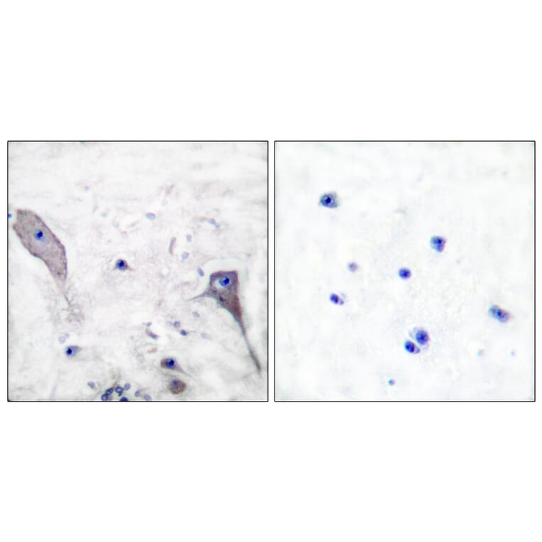 Immunohistochemistry - Anti-Patched Antibody (C0296) - Antibodies.com