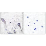 Immunohistochemistry - Anti-Patched Antibody (C0296) - Antibodies.com