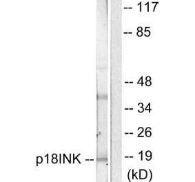 Western Blot - Anti-p18 INK Antibody (C0288) - Antibodies.com