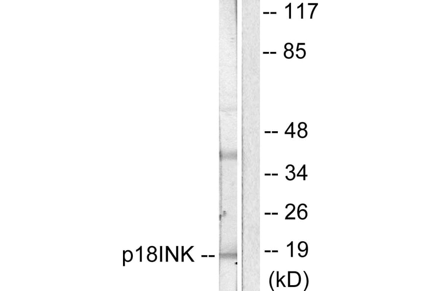 Western Blot - Anti-p18 INK Antibody (C0288) - Antibodies.com