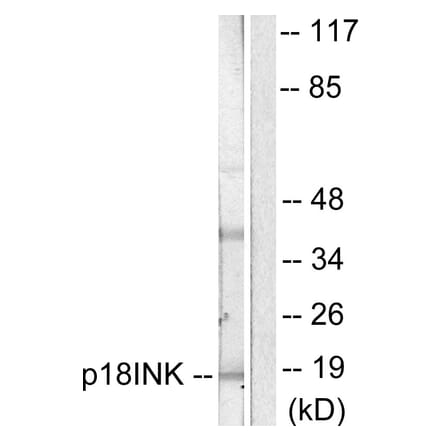 Western Blot - Anti-p18 INK Antibody (C0288) - Antibodies.com