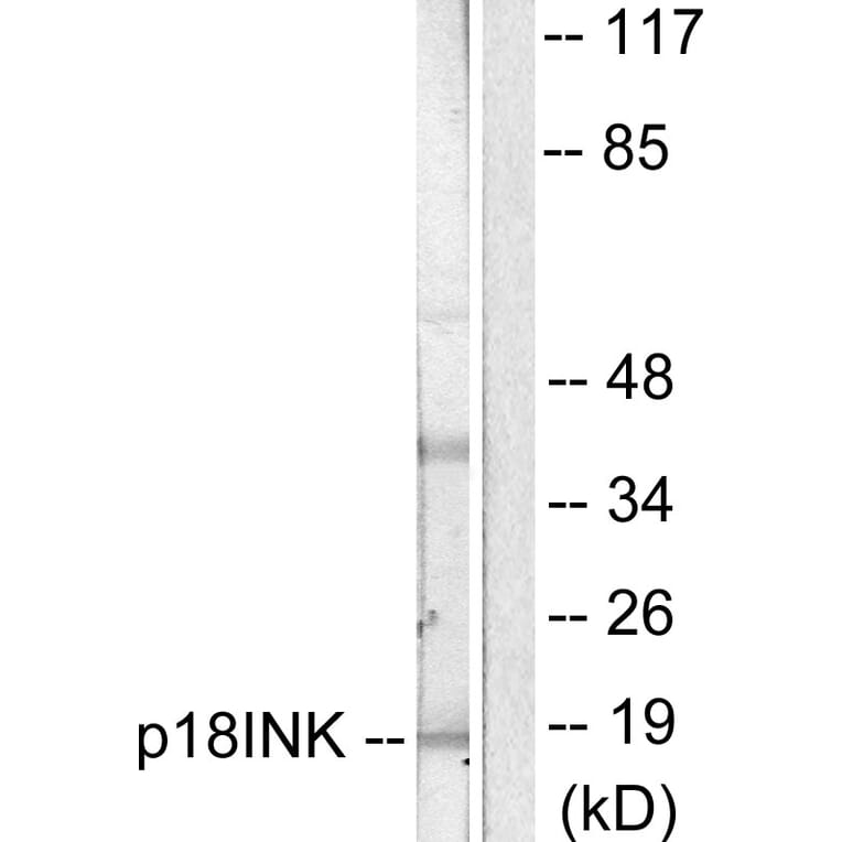Western Blot - Anti-p18 INK Antibody (C0288) - Antibodies.com
