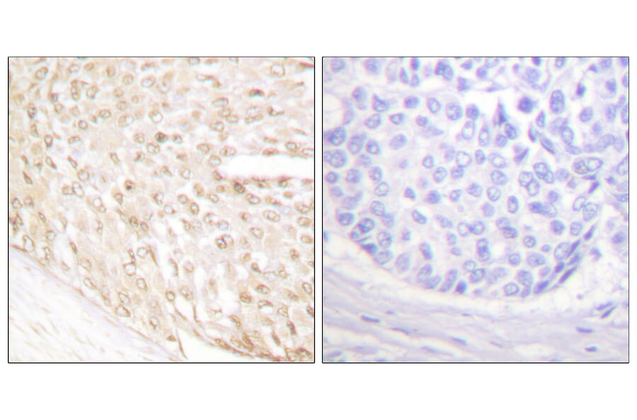 Immunohistochemistry - Anti-p18 INK Antibody (C0288) - Antibodies.com