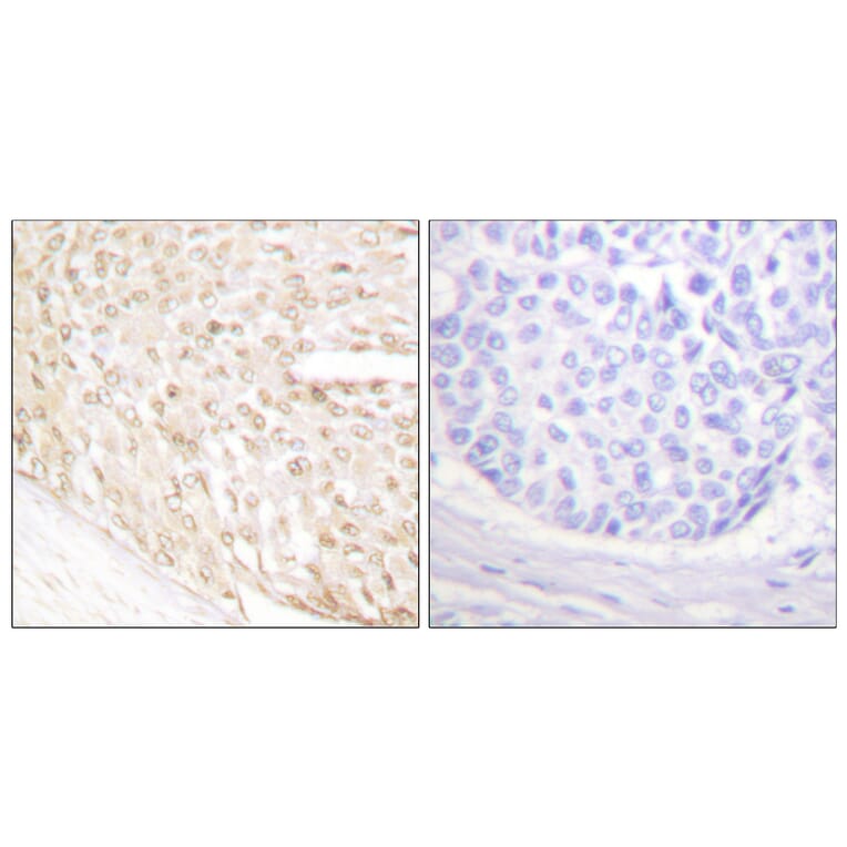 Immunohistochemistry - Anti-p18 INK Antibody (C0288) - Antibodies.com