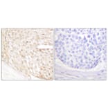 Immunohistochemistry - Anti-p18 INK Antibody (C0288) - Antibodies.com