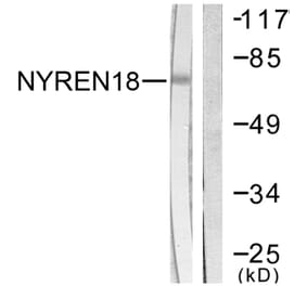 Western Blot - Anti-NYREN18 Antibody (C0360) - Antibodies.com