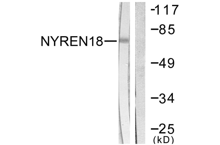 Western Blot - Anti-NYREN18 Antibody (C0360) - Antibodies.com