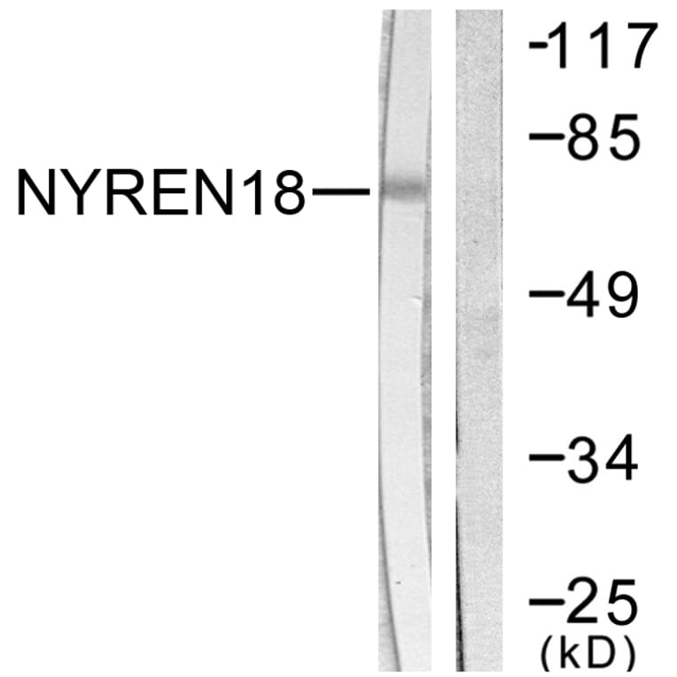 Western Blot - Anti-NYREN18 Antibody (C0360) - Antibodies.com