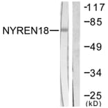 Western Blot - Anti-NYREN18 Antibody (C0360) - Antibodies.com