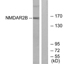 Western Blot - Anti-NMDAR2B Antibody (B0526) - Antibodies.com