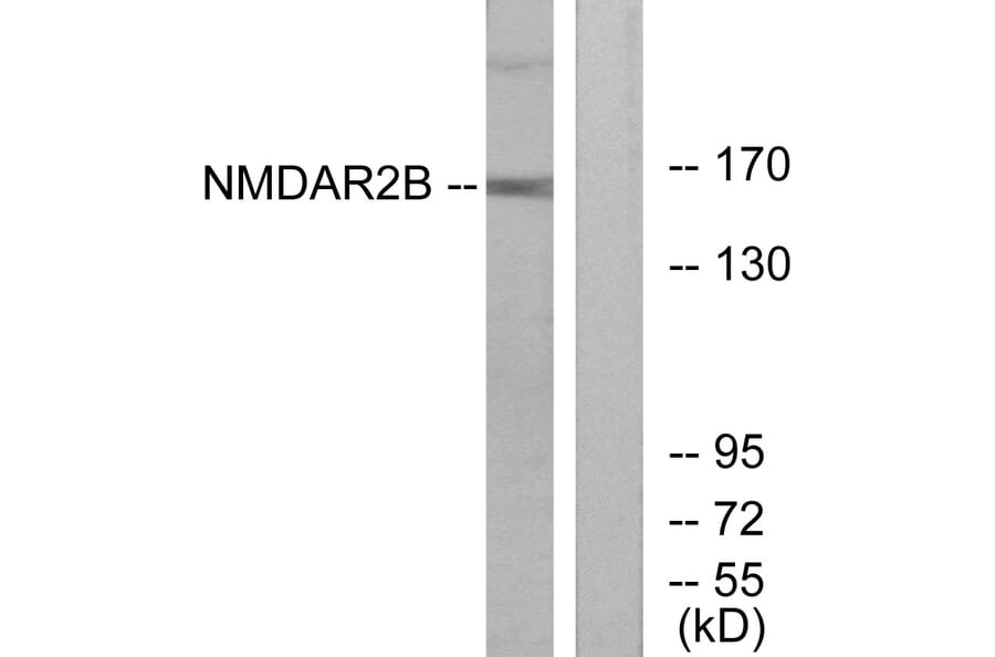 Western Blot - Anti-NMDAR2B Antibody (B0526) - Antibodies.com