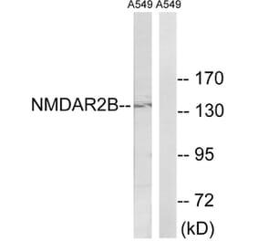 Western Blot - Anti-NMDAR2B Antibody (B8257) - Antibodies.com