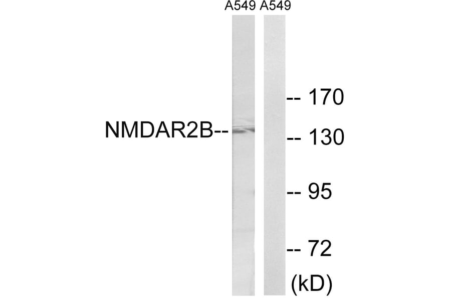 Western Blot - Anti-NMDAR2B Antibody (B8257) - Antibodies.com