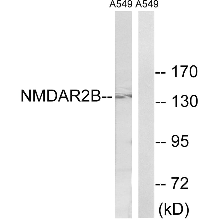 Western Blot - Anti-NMDAR2B Antibody (B8257) - Antibodies.com