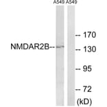 Western Blot - Anti-NMDAR2B Antibody (B8257) - Antibodies.com