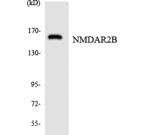 Western Blot - Anti-NMDAR2B Antibody (R12-3097) - Antibodies.com