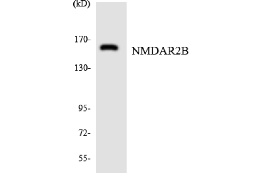 Western Blot - Anti-NMDAR2B Antibody (R12-3097) - Antibodies.com