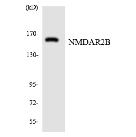 Western Blot - Anti-NMDAR2B Antibody (R12-3097) - Antibodies.com