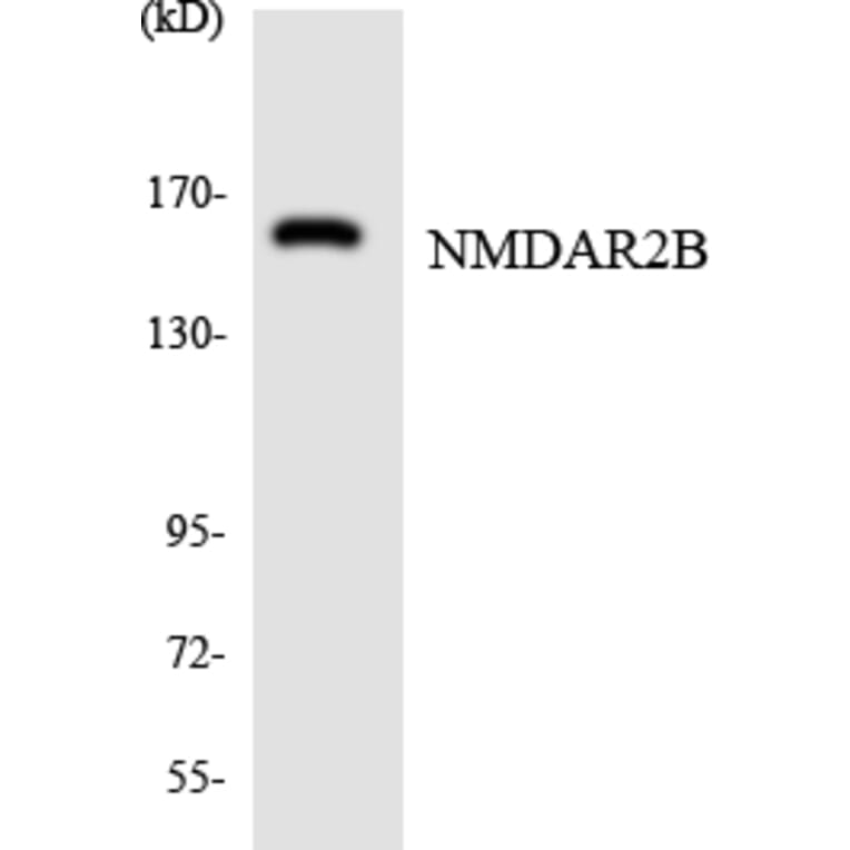 Western Blot - Anti-NMDAR2B Antibody (R12-3097) - Antibodies.com